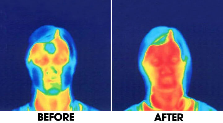 Two photos showing comparison of face blood circulation flow. Before and after face yoga.