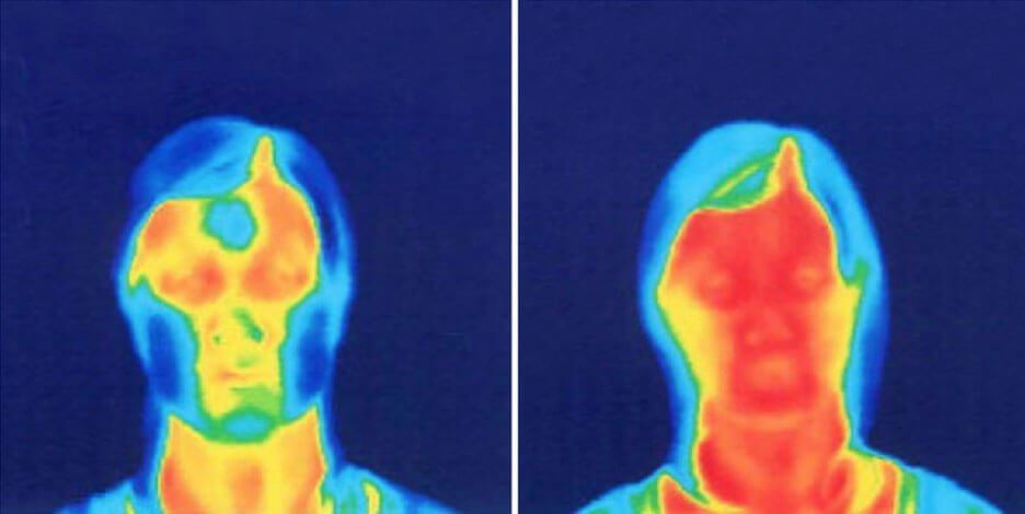 Two thermographic images featuring comparison of close-up faces before and after face yoga
