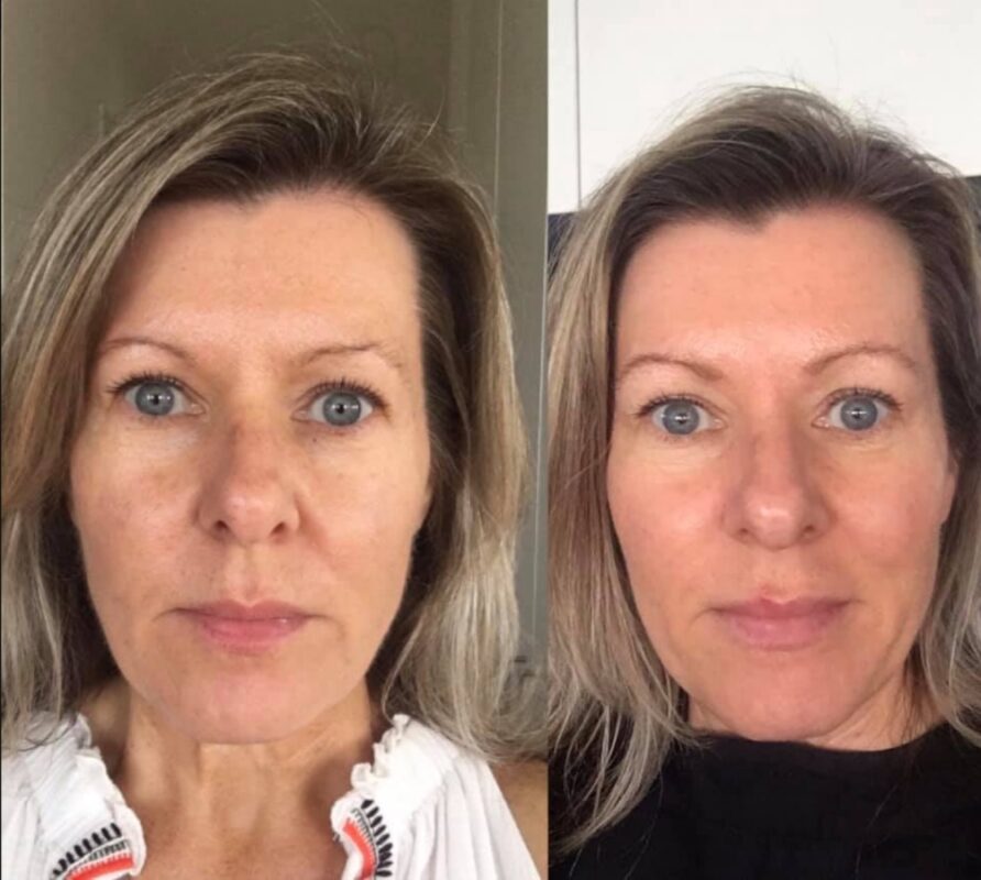 Do Facial Exercises Really Work? FACE YOGA METHOD